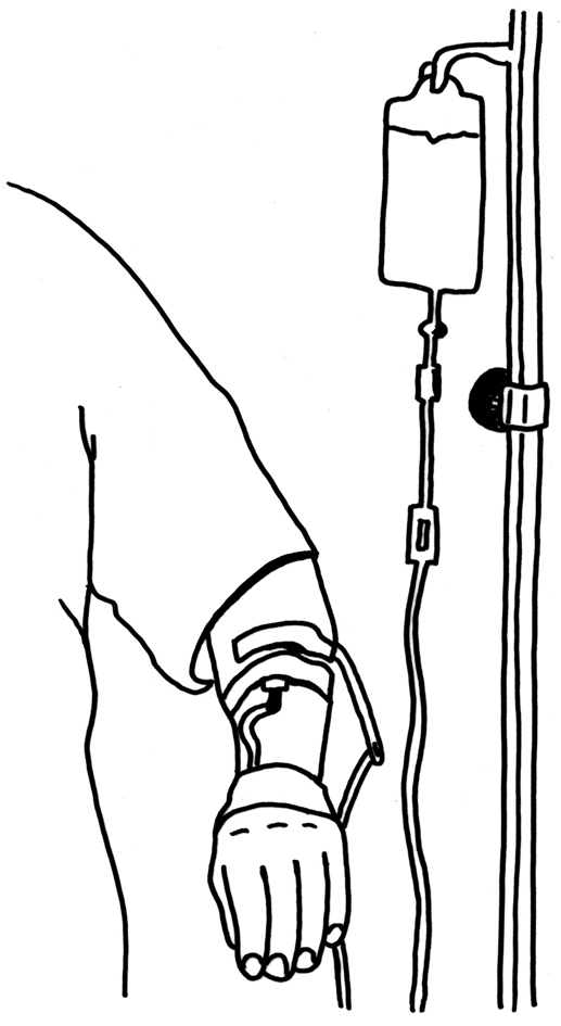 drip intravenous